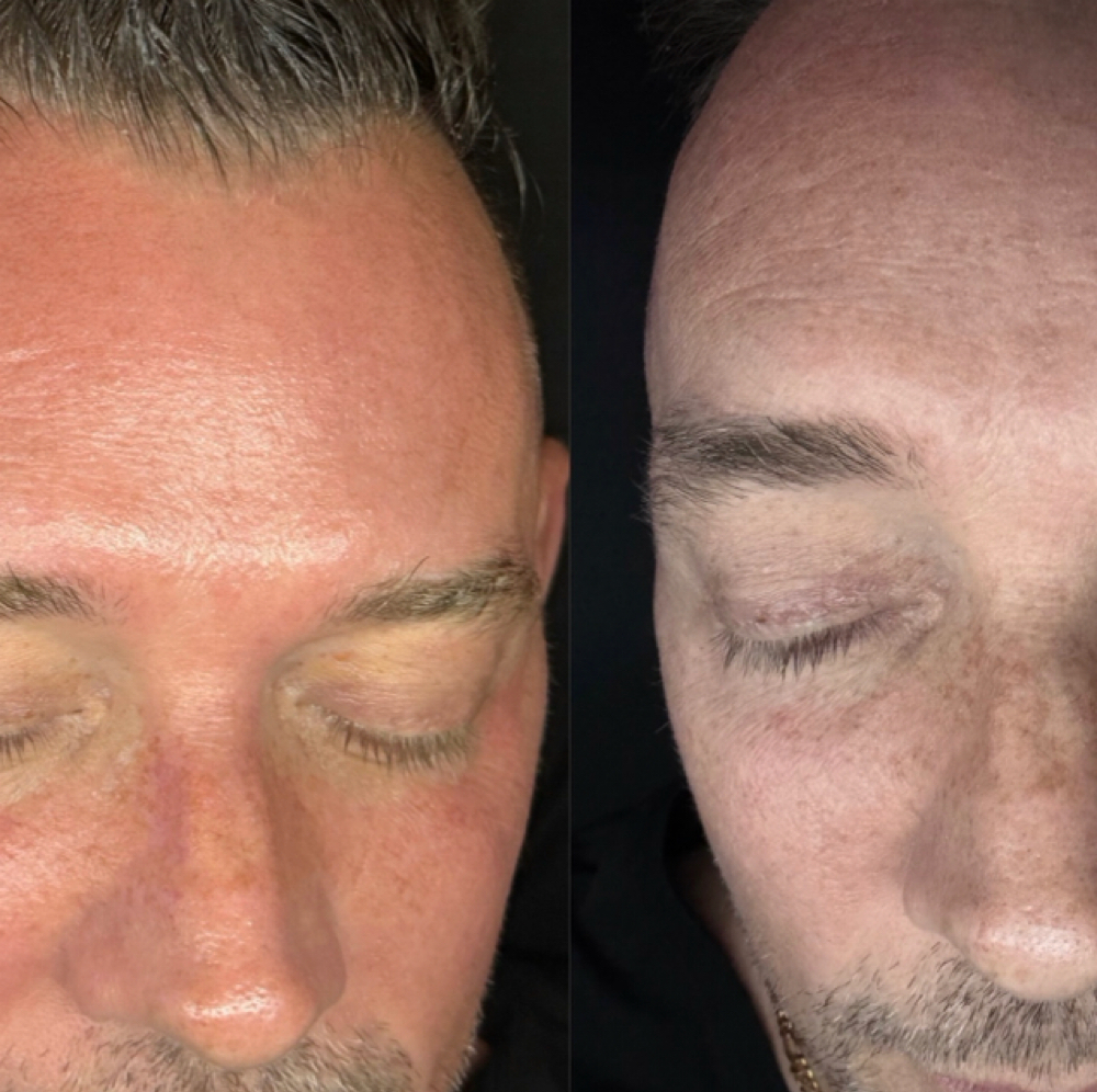 THE CLINICAL GLOW RESET at Affinity & Glow Aesthetics in Royal Oak, MI