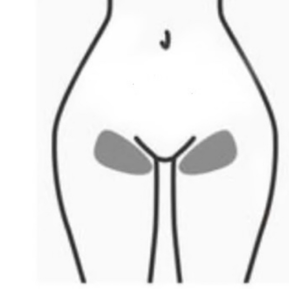 Bikini Line (Woman Only) at Beauty Esthetics Loft in Denver, CO