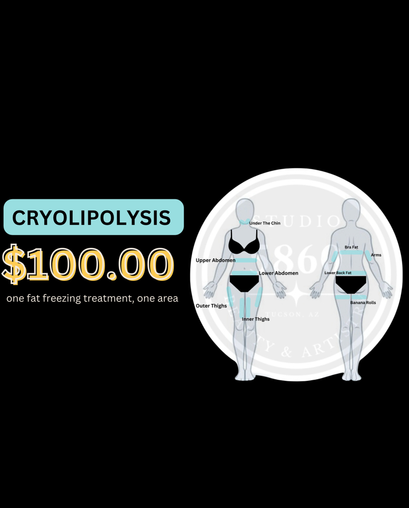 $100.00 Cryolipoysis