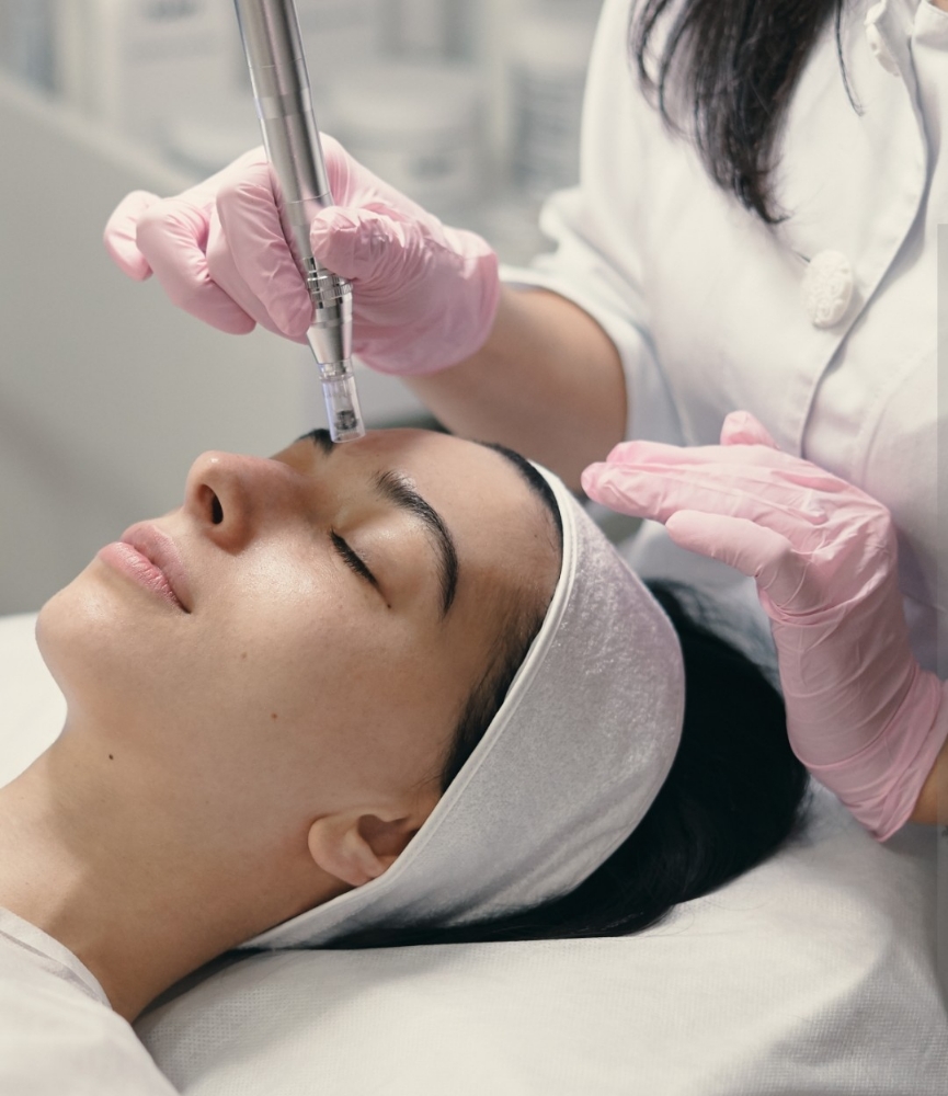 Micro-Needling