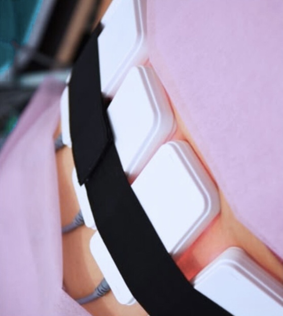 Laser Lipo (6 Sessions)