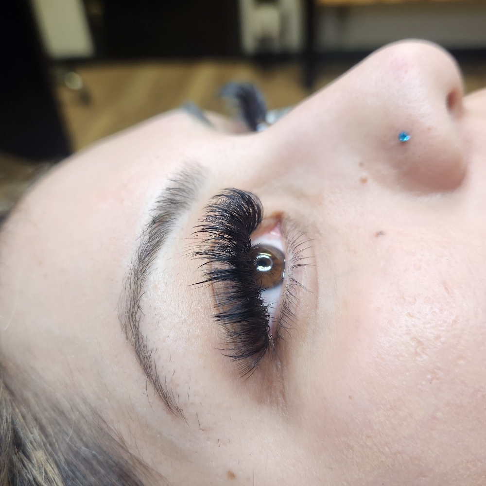 MEGA Volume Fill (3 Weeks) at No Filter Aesthetic’s in Redding, CA