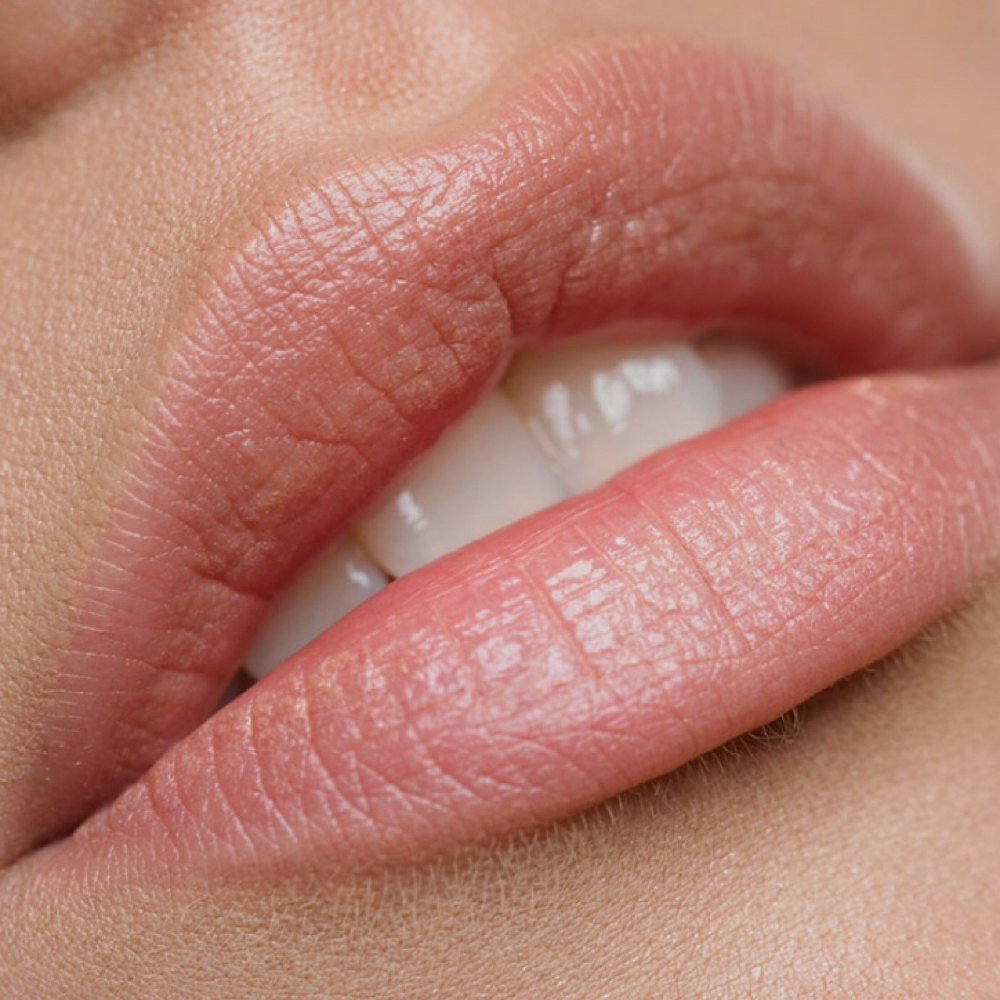 Lip Filler (1/2 syringe) at Grace Infused Wellness & Aesthetics in Broken Bow, OK