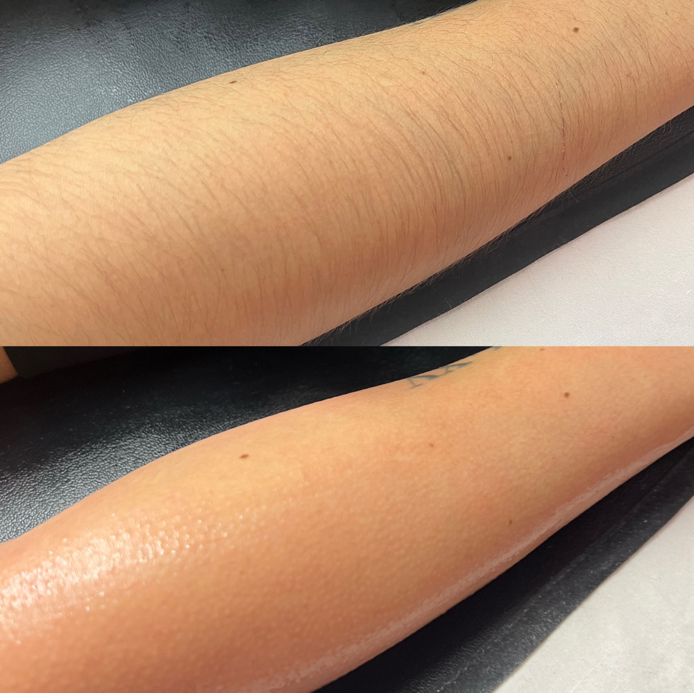 Arms Sugar Wax at Beauty & Esthetics by Sol Luna in Inglewood, CA