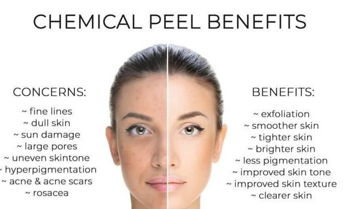 UltraBright "Peel"