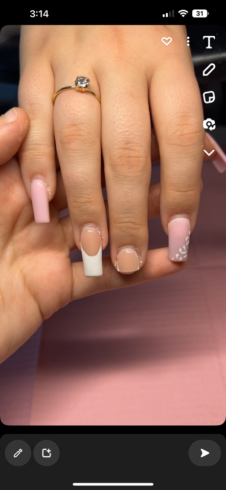 Nail Rapair / Fix