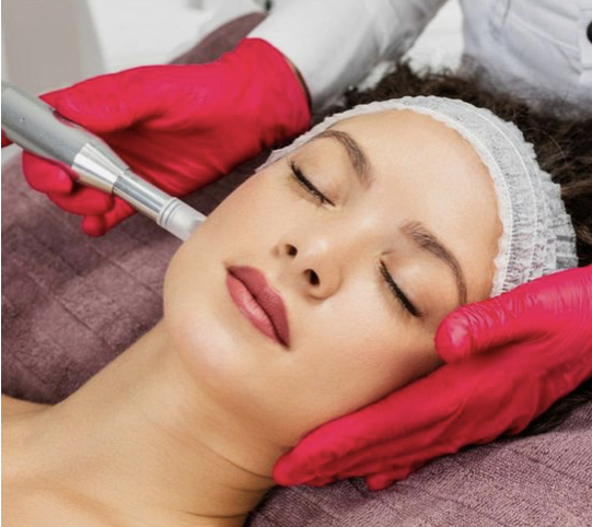 Microneedling