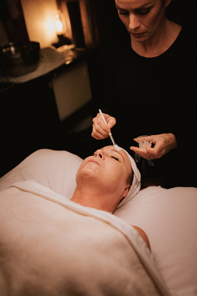 Professional Chemical Peel