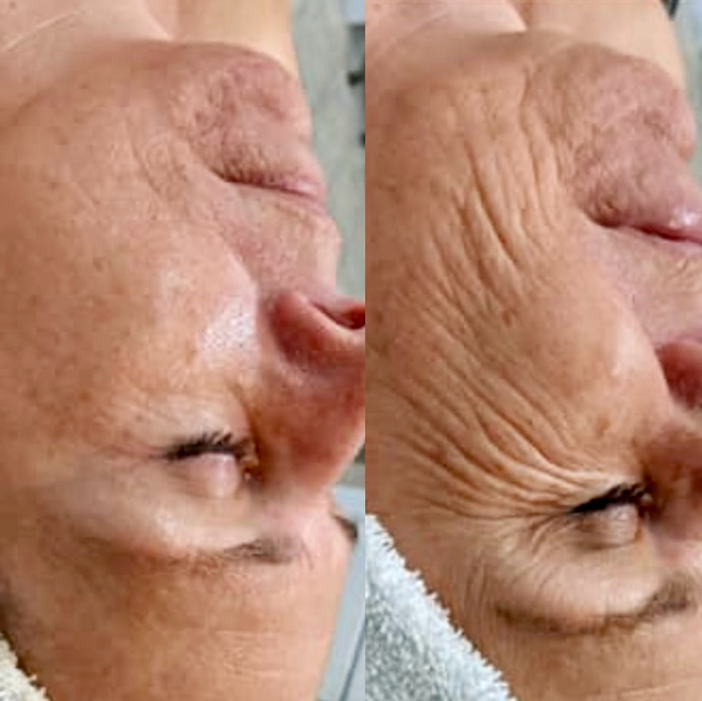 Luxe Lift Facial