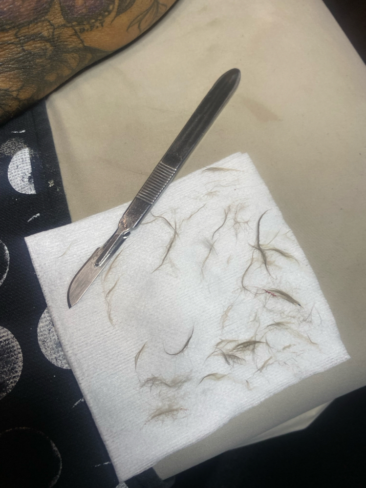 Dermaplane Add on