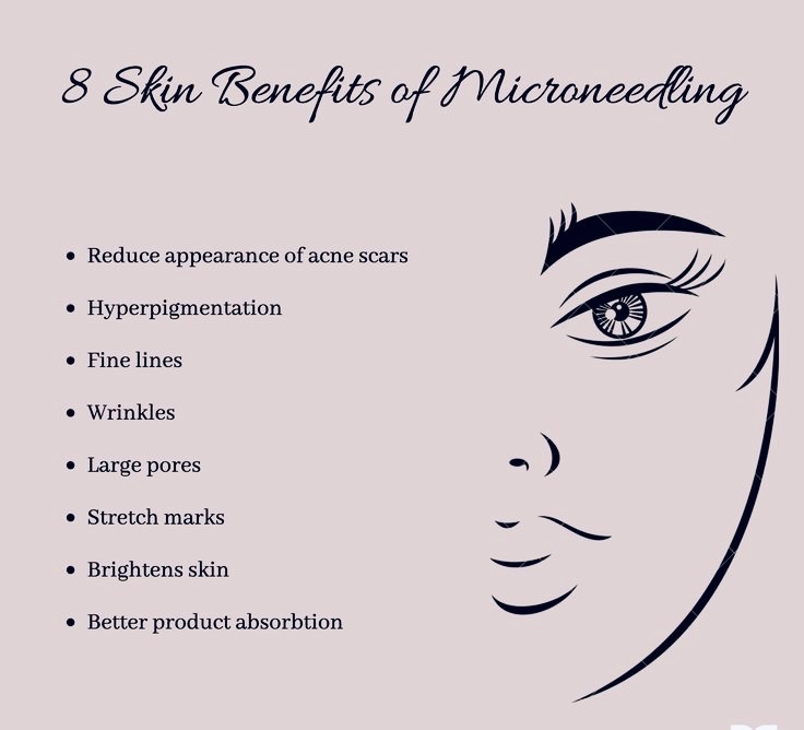 MicroNeedling