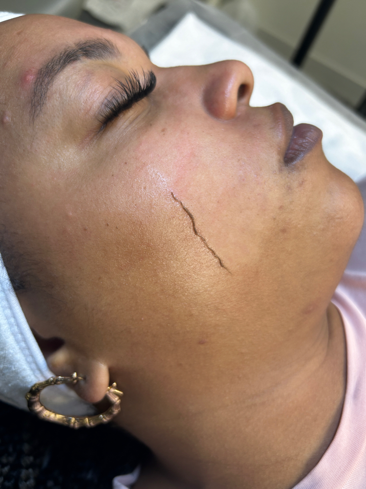 Signature Dermaplane Facial