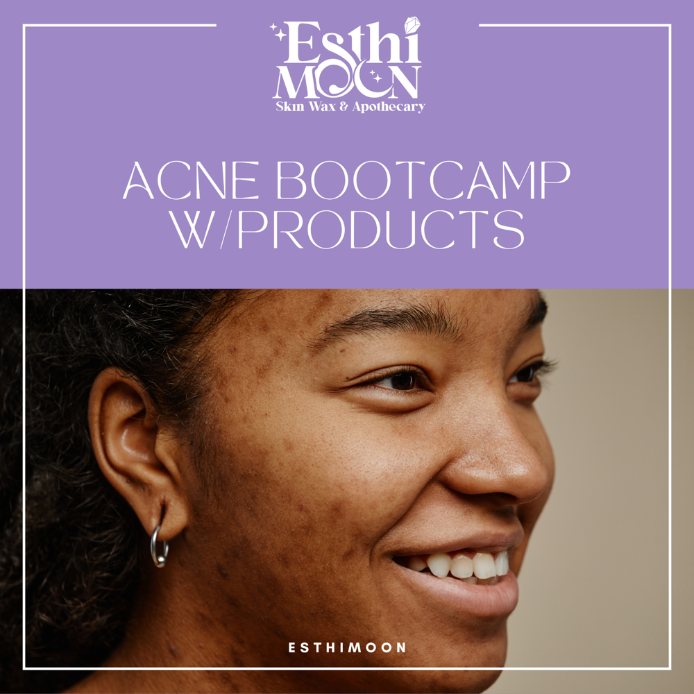 ACNE BOOTCAMP W/PRODUCTS