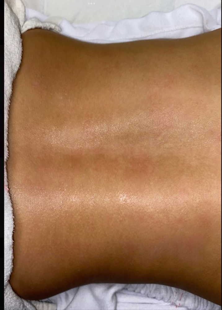 Back Wax at Luna Vita Esthetics in Lowell, AR
