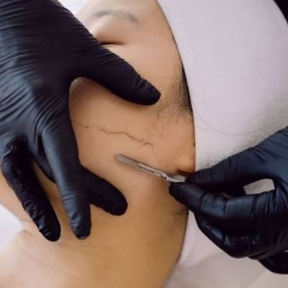 Dermaplane Add-On at Flawless Glow Esthetics in Fayetteville, GA