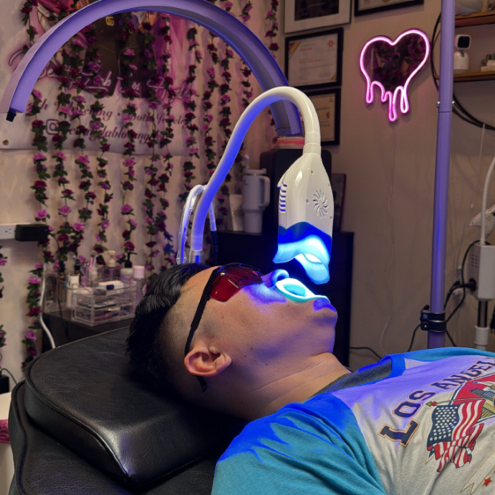 Whitening & Tooth Gem at Beauty Lab Los Angeles in Los Angeles, CA