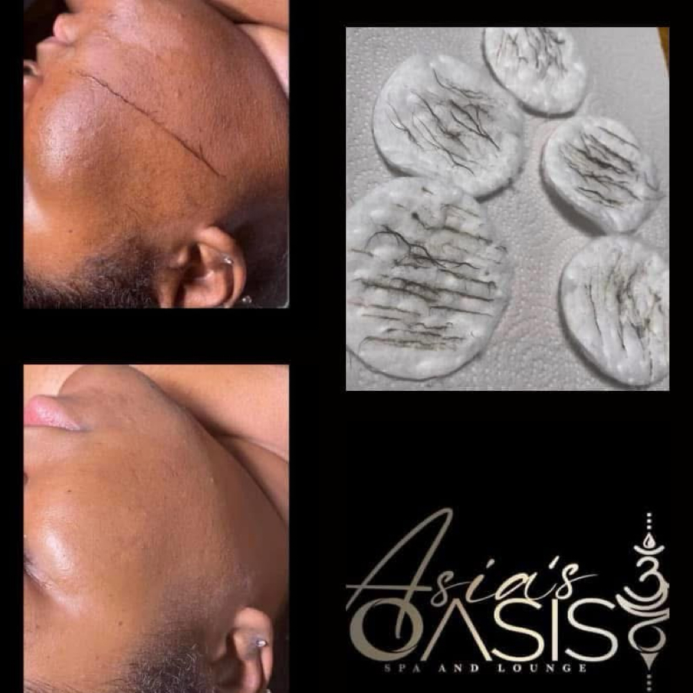 Dermaplane  Facial at Asia’s Oasis in Syracuse NY, NY