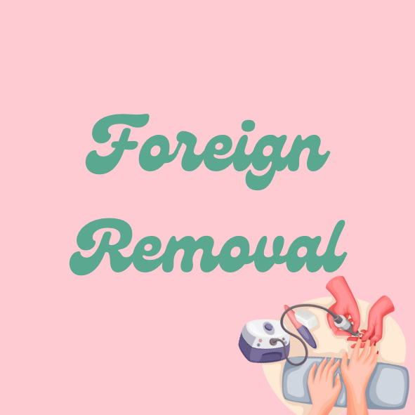 Foreign Removal
