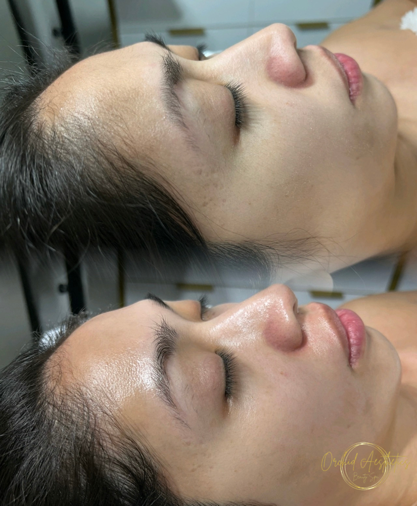 SIGNATURE DERMAPLANING FACIAL