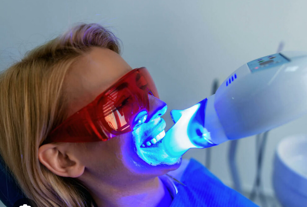 Professional Teeth Whitening