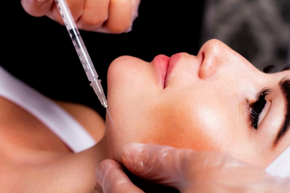 Botox - 40 Units