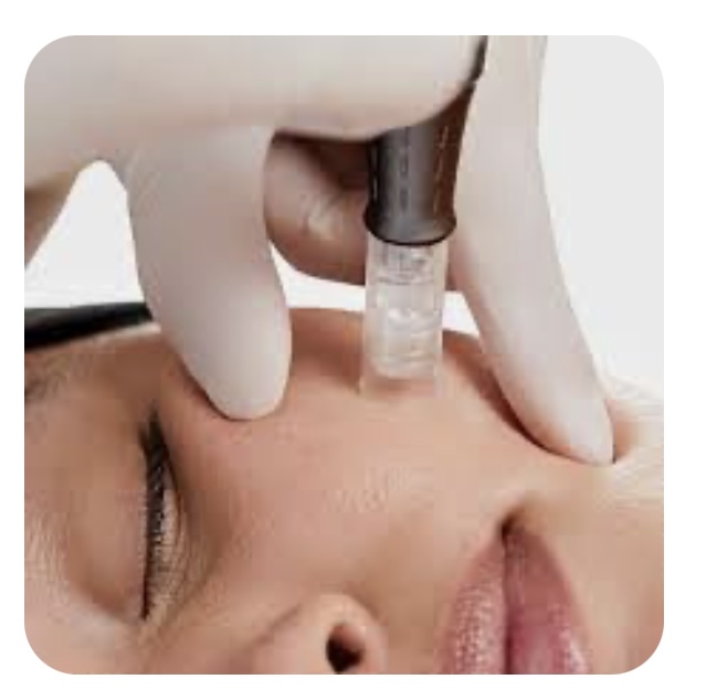 Nano-needling