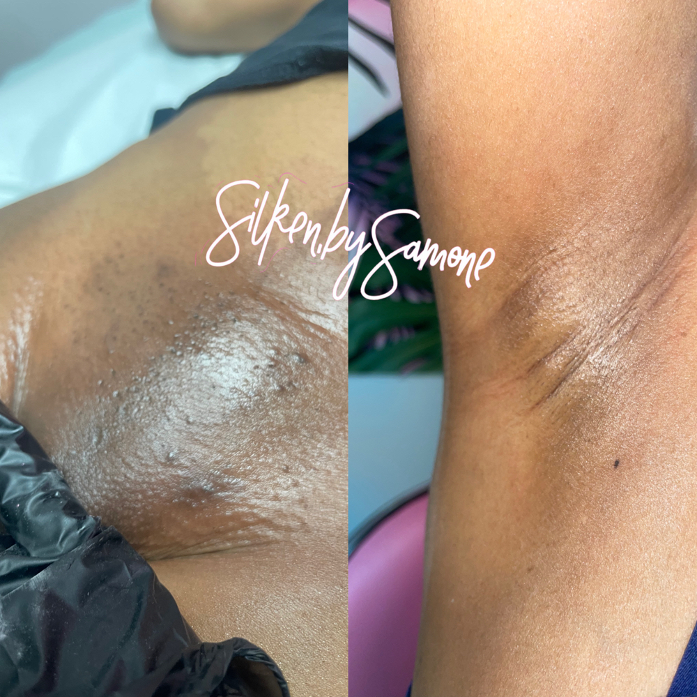 Brazilian wax + underarm