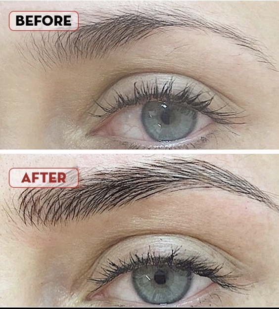 Touch Up 10-12 Weeks (2nd)