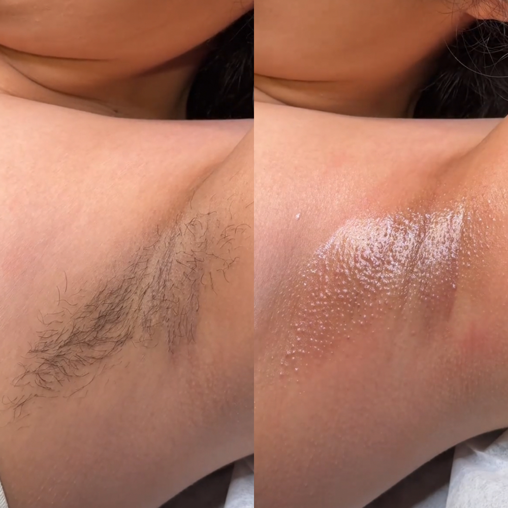 UNDERARM WAX at Revenge Beauty in New Braunfels, TX