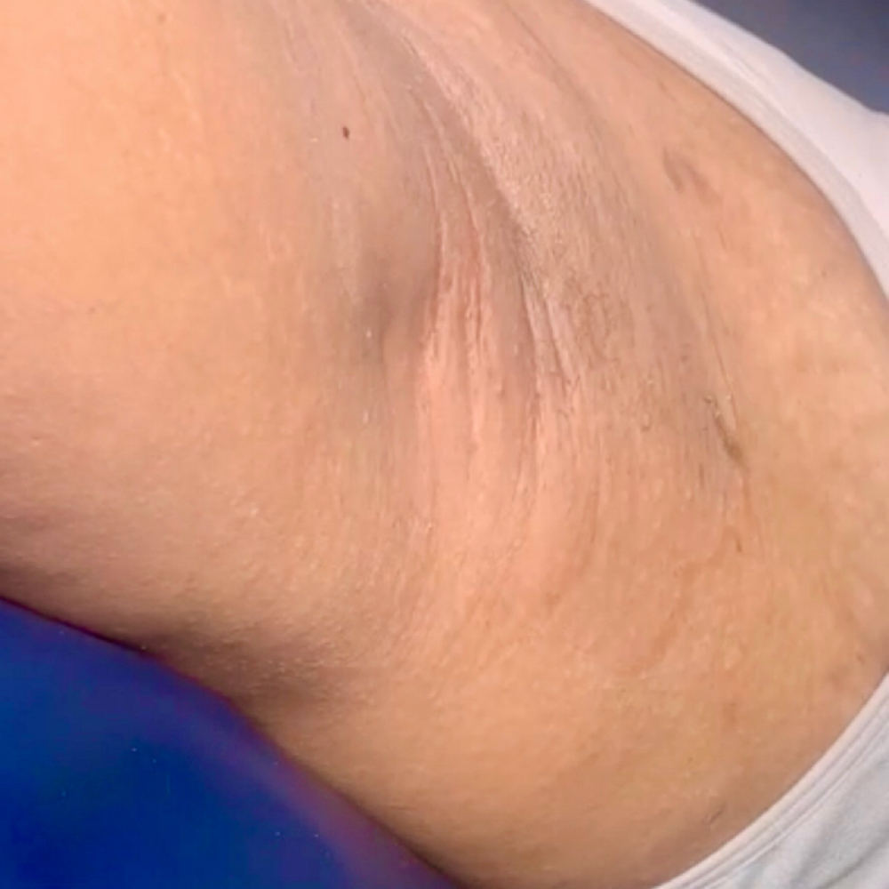 Arm Wax at Goddess Glows Esthetics in Columbia, SC