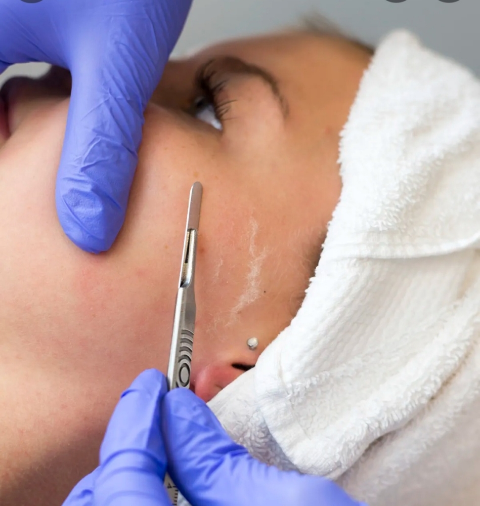 Dermaplane + Light Therapy