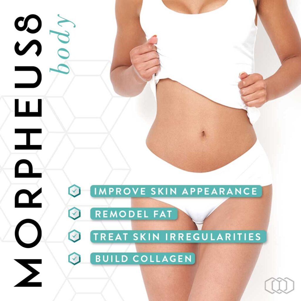 Morpheus8 BODY