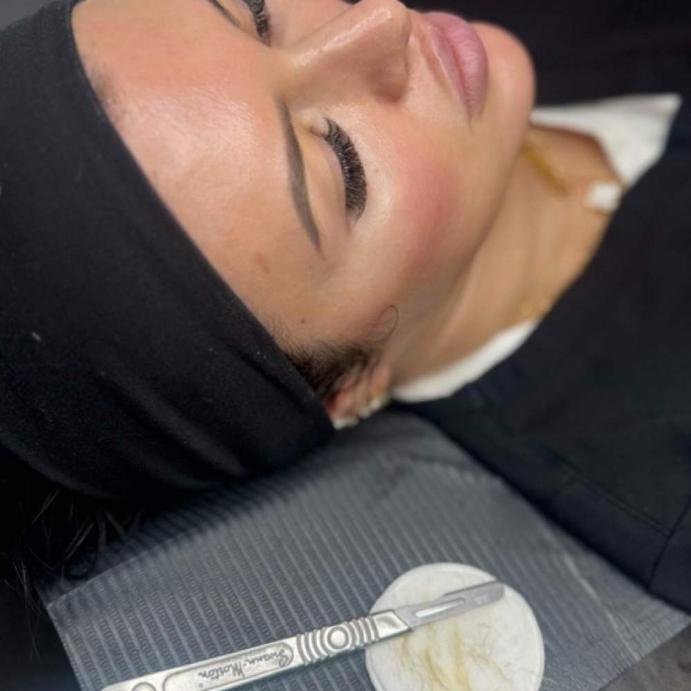 Glowy Medical-grade Dermaplaning