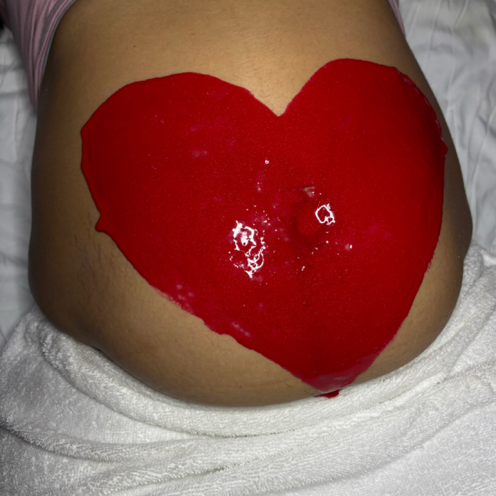 Baby Bump Facial at Live Lovely Esthetics in Richardson, TX