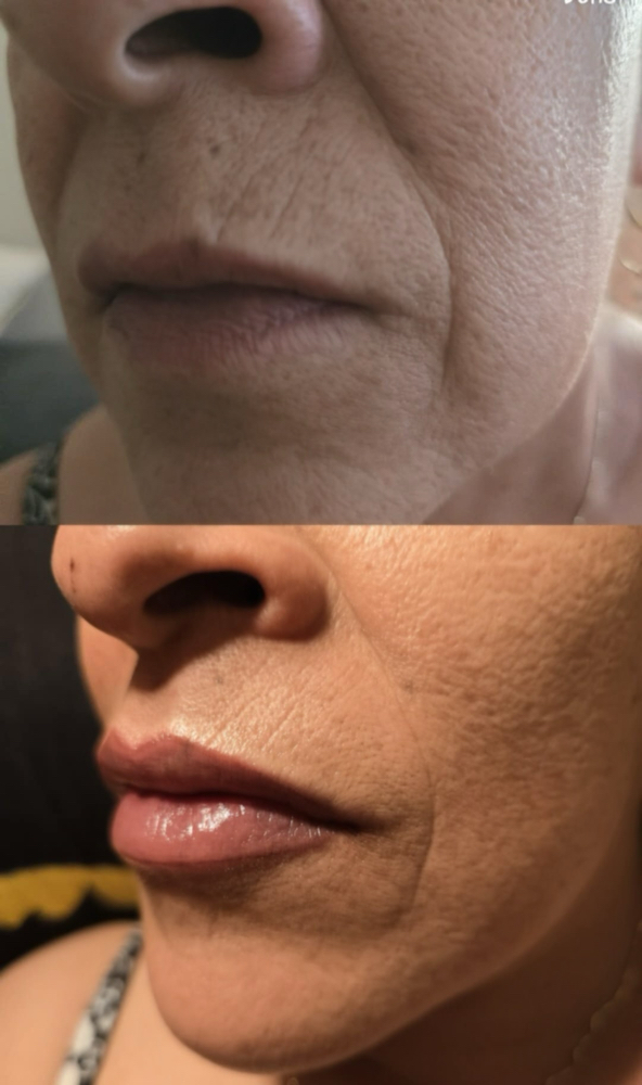Lip Blush at Deja*Vu Tox And More in El Paso, TX