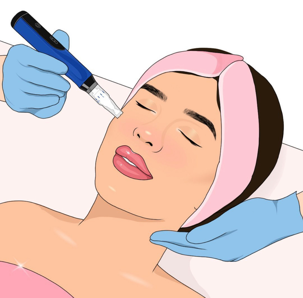 SkinPen Microneedling