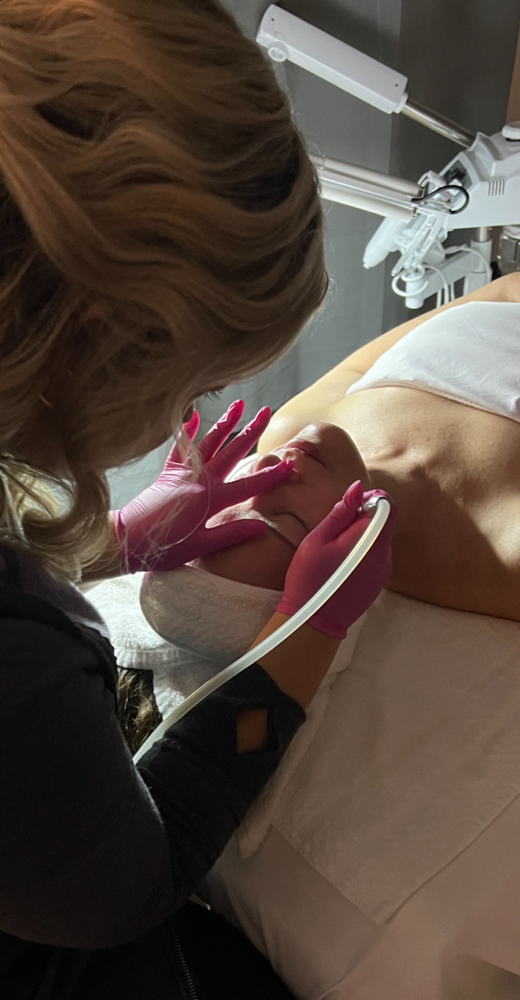 Microdermabrasion Facial