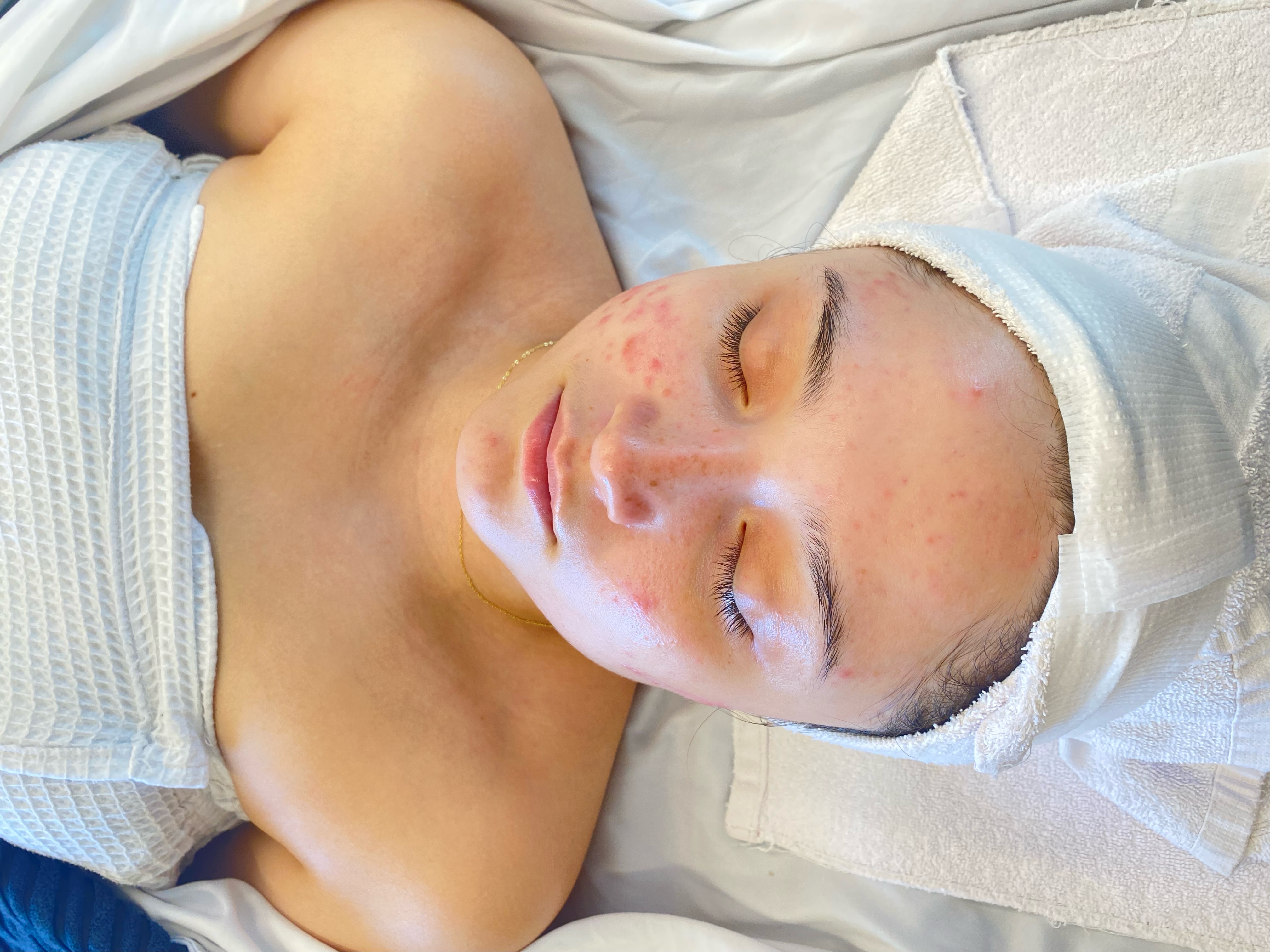60min facial