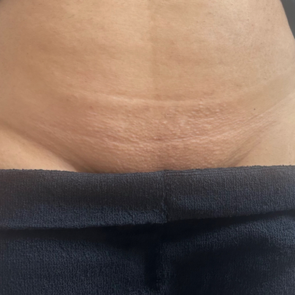 SUGAR BRAZILIAN ☆ at MY WAX LADY LIZ in Bell Gardens, CA