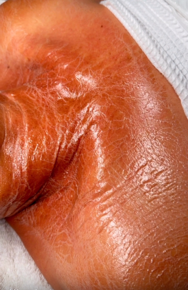 luxury lift facial  🌿🌱