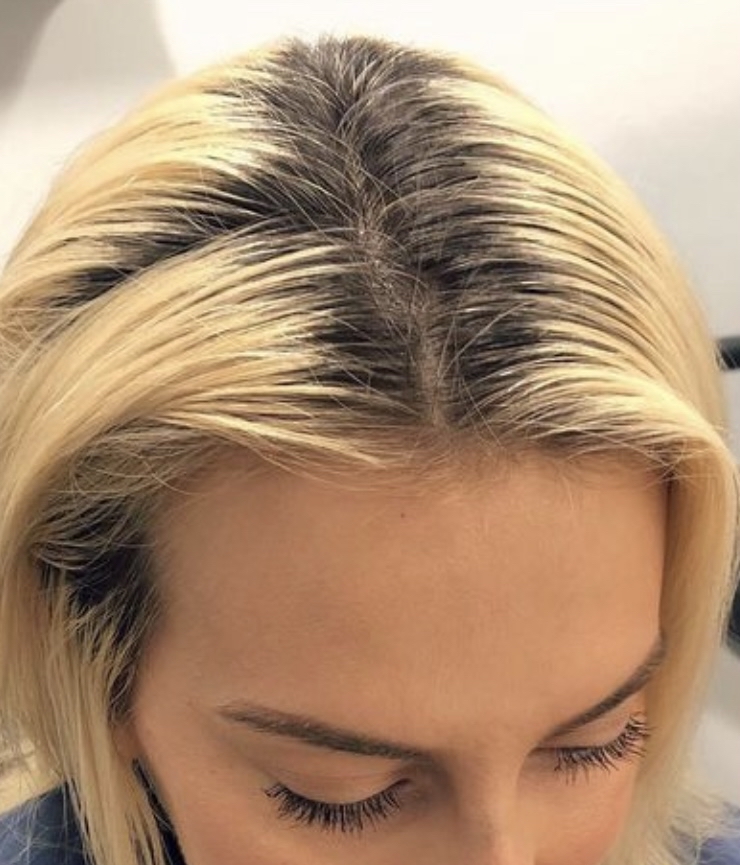 Root Touch Up