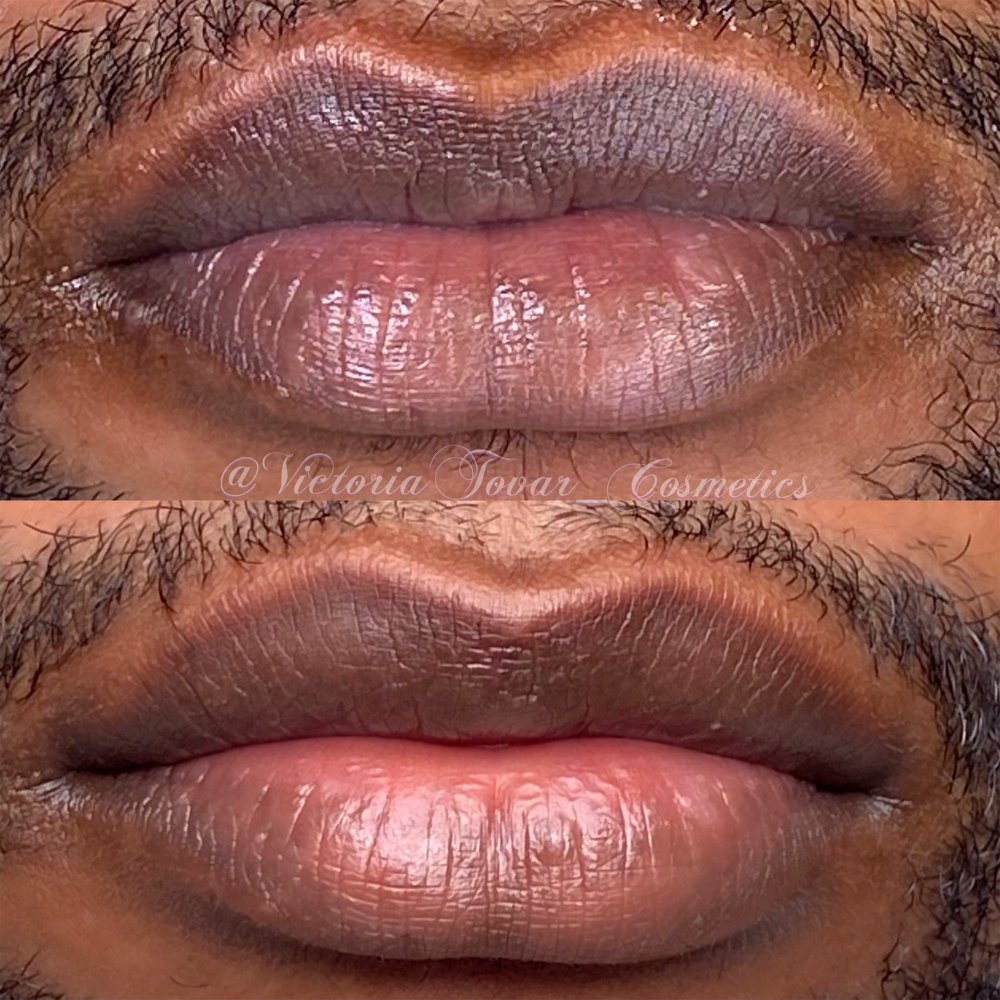 Lip Neutralization