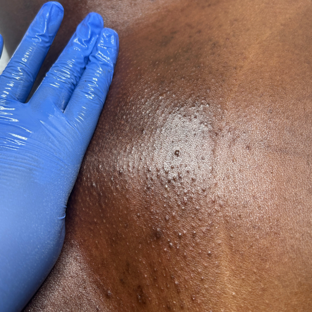 Brazilian First Time Client