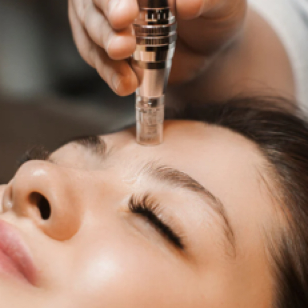 Nano-infusion Facial at AK Aesthetics in Downers Grove, IL