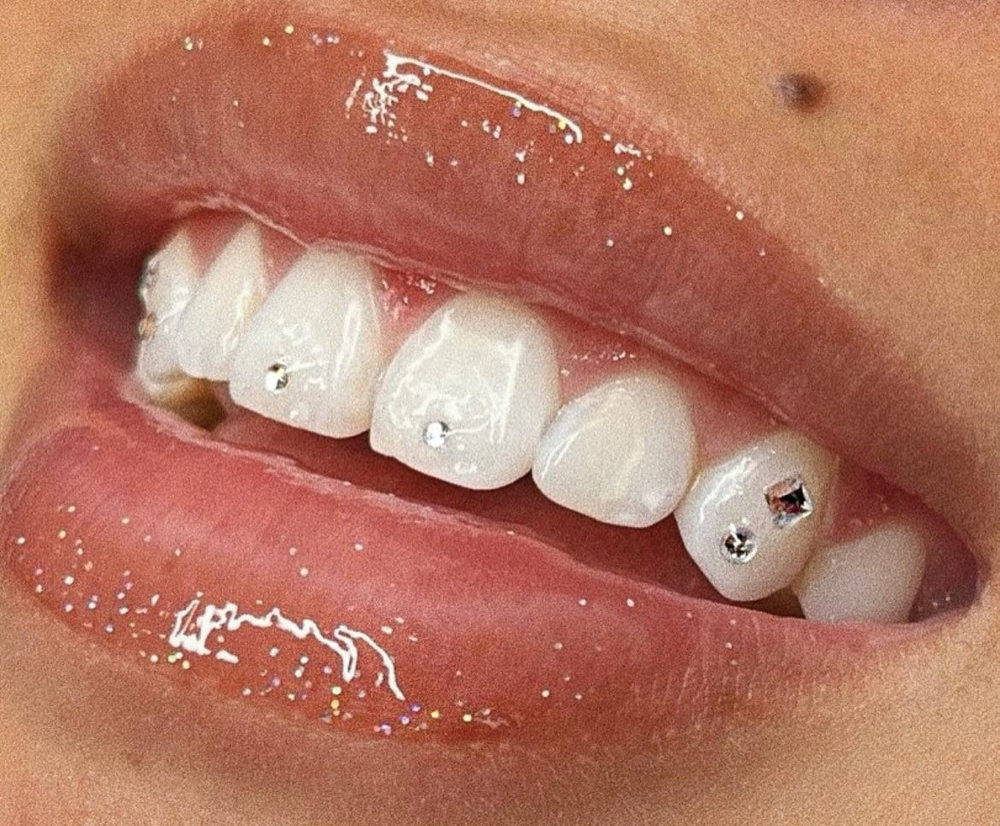 Teeth Gem Class