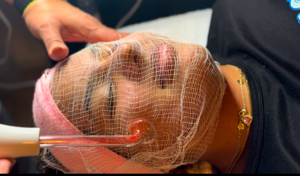Level 2: Advanced Acne Facial