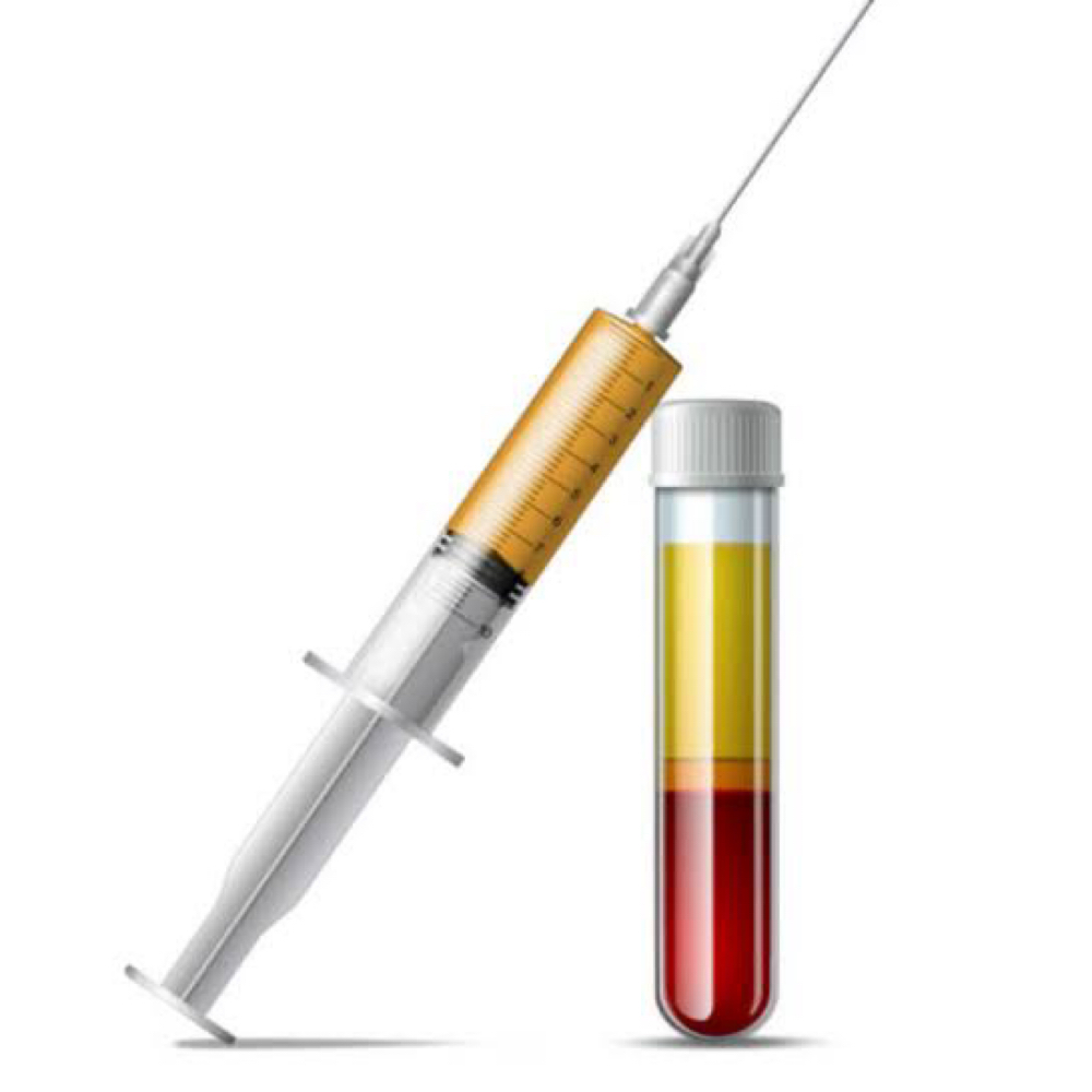 EZ Gel PRF- Under Eye Filler