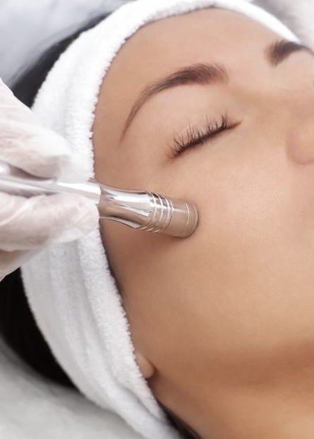 Microdermabrasion Treatment at Marina Novak in North Palm Beach, FL