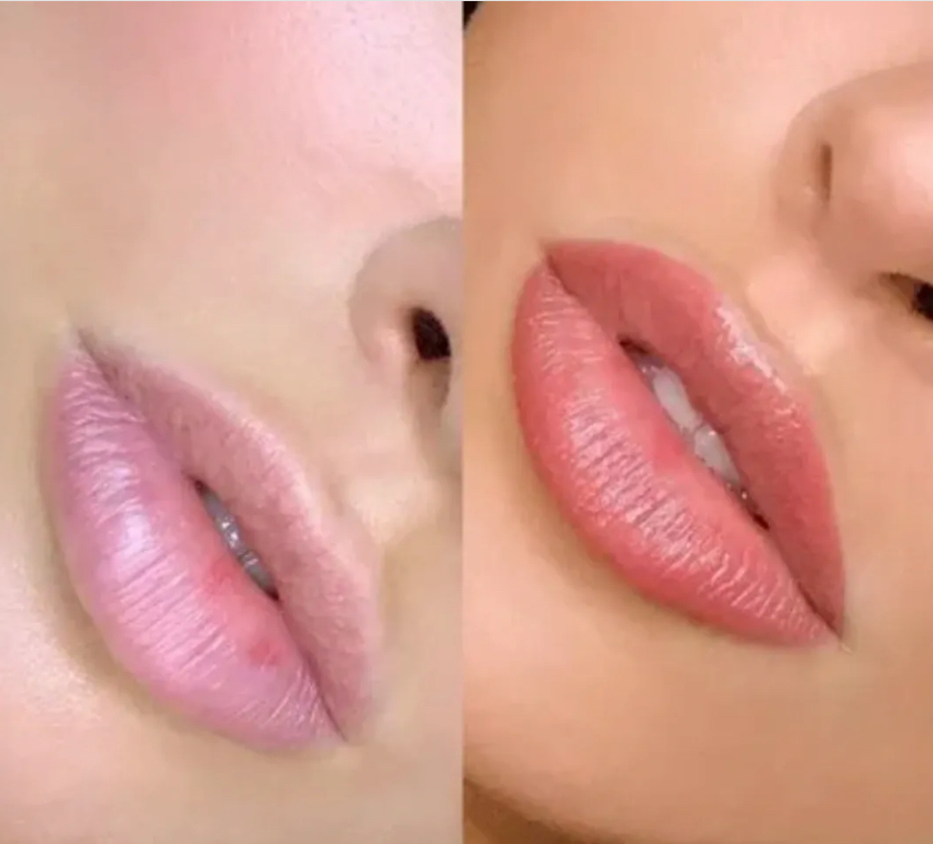 Permanant Lip Blush