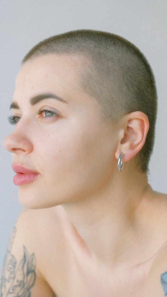Scalp Micropigmentation